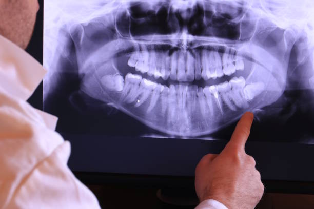 Best Emergency Broken Tooth Repair in Forest, MS