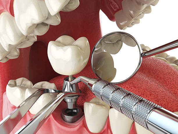 Best Emergency Orthodontic Repairs in Forest, MS